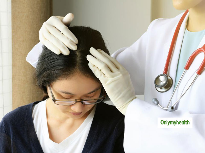 Scalp Pimple: सिर के मुंहासे से हैं परेशान, दूर करने के लिए अपनांए ये टिप्स